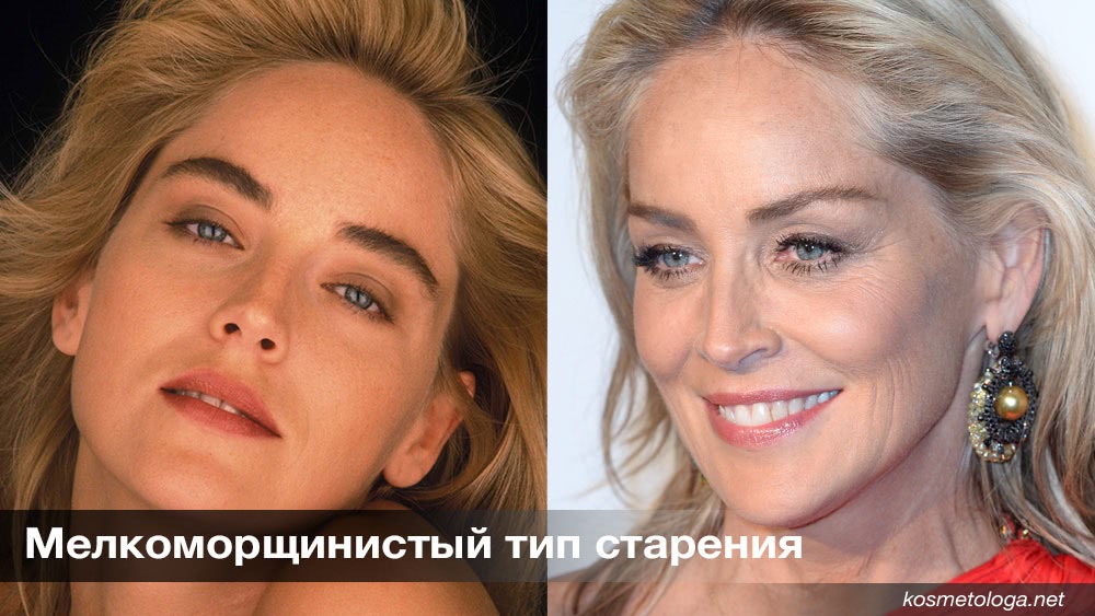 Как определить свой тип старения